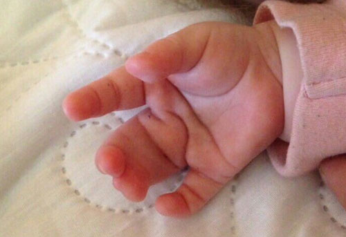 Congenital Malformations
