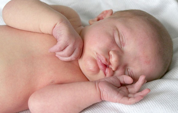 Congenital Malformations